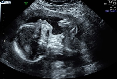 1.2.276.0.26.1.1.1.2.2018.325.62428.4644795.778240